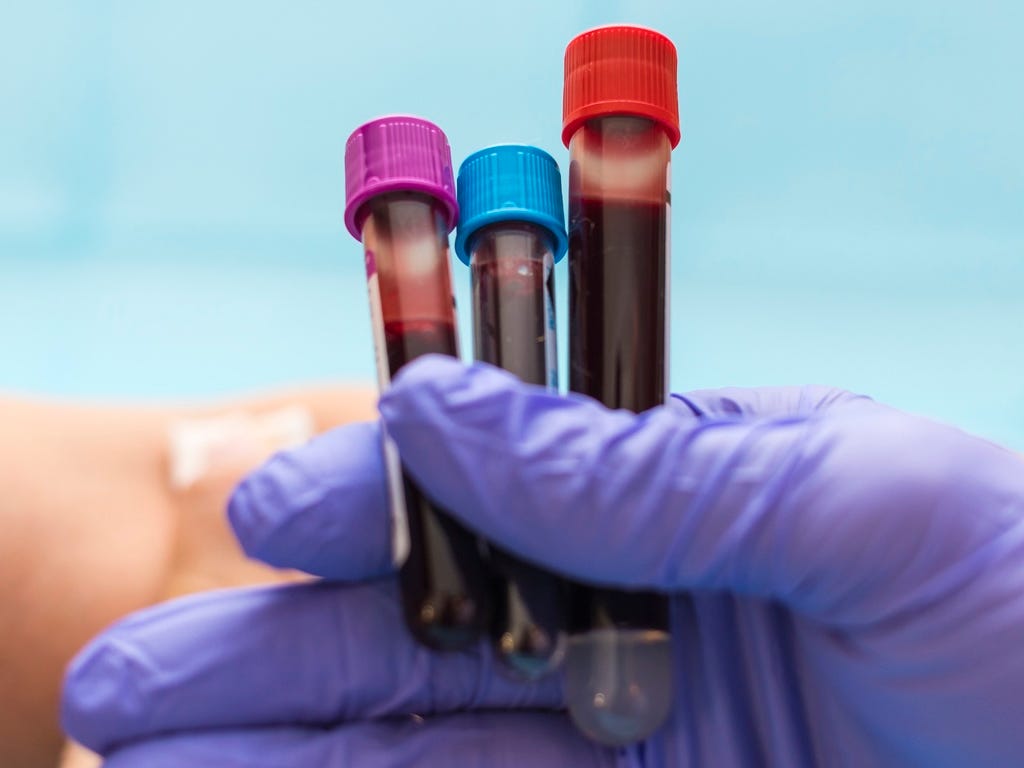 Tuổi sinh học của não có thể quyết định tuổi thọ của bạn?- Ảnh 2. Nghiên cứu về tuổi sinh học bộ não và Alzheimer