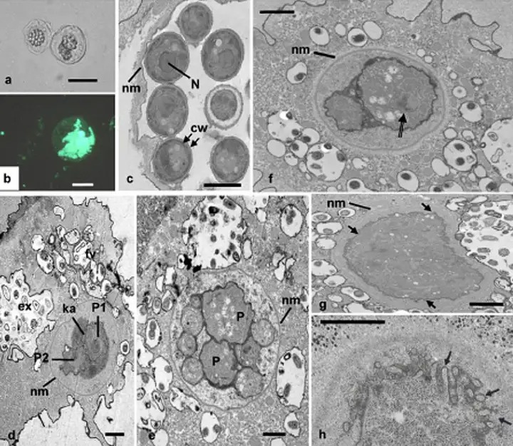 Virus có phải là sinh vật sống không? Tranh cãi kéo dài hàng thập kỷ và những khám phá mới đang thay đổi câu trả lời- Ảnh 5. Sinh vật thực nhân có đặc điểm giống virus