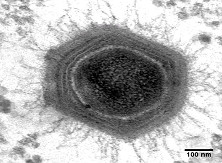 Virus có phải là sinh vật sống không? Tranh cãi kéo dài hàng thập kỷ và những khám phá mới đang thay đổi câu trả lời- Ảnh 1. Virus khổng lồ Mimivirus dưới kính hiển vi