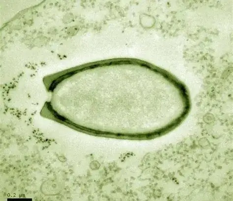 Virus có phải là sinh vật sống không? Tranh cãi kéo dài hàng thập kỷ và những khám phá mới đang thay đổi câu trả lời- Ảnh 2. Virus Pandoravirus kích thước lớn