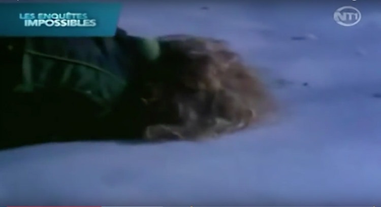 Bệnh viện nơi Jean được điều trị Phòng cấp cứu tại bệnh viện Fosston