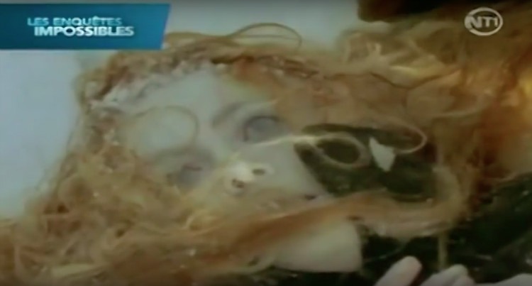 Jean hồi phục kỳ diệu sau khi được làm ấm Jean bắt đầu lấy lại ý thức